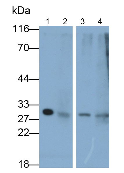 Polyclonal Antibody to Carbonic Anhydrase VA (CA5A)