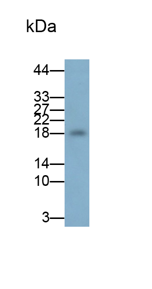 Polyclonal Antibody to Hemoglobin Epsilon 1 (HBe1)