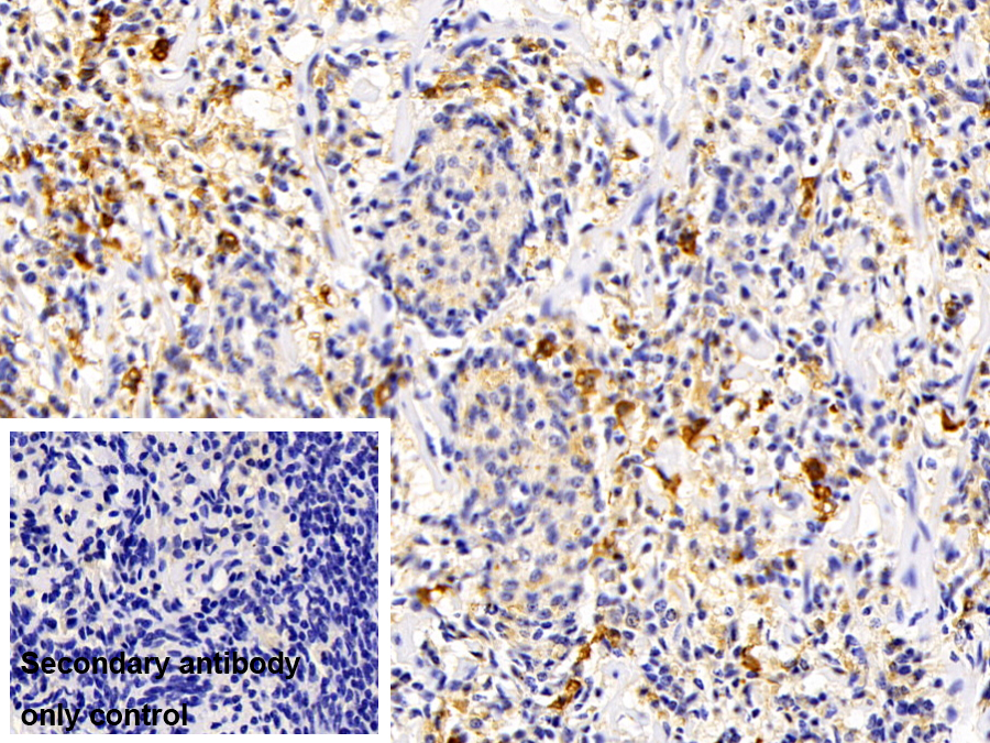 Polyclonal Antibody to Hemoglobin Beta (HBb)