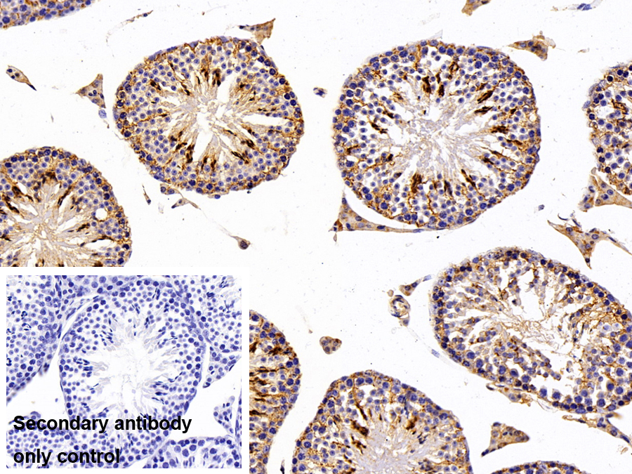 Polyclonal Antibody to Low Density Lipoprotein Receptor Related Protein Associated Protein 1 (LRPAP1)