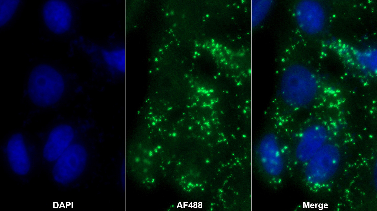 Polyclonal Antibody to Fibulin 5 (FBLN5)