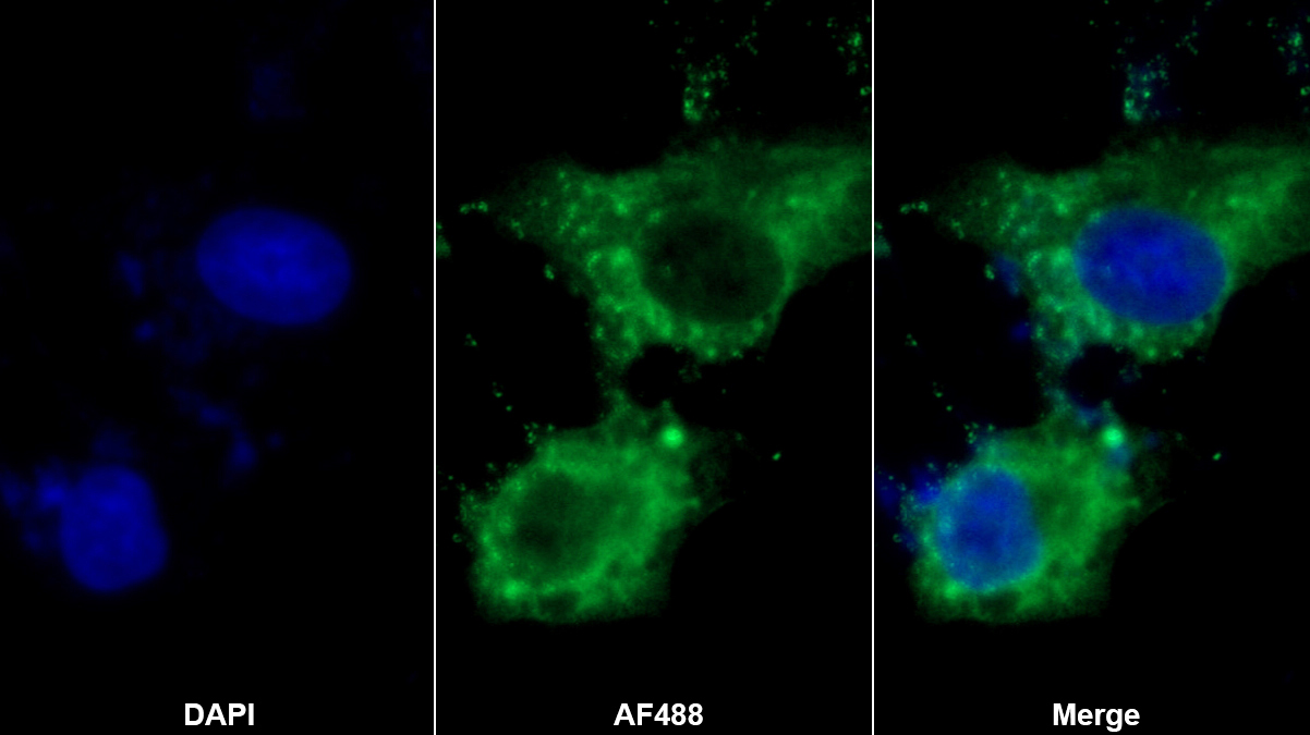 Polyclonal Antibody to Fibulin 5 (FBLN5)