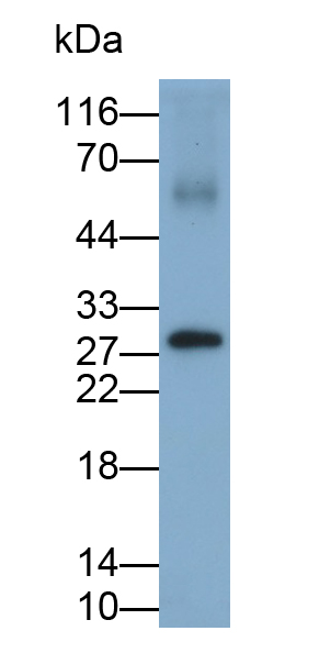 Polyclonal Antibody to Ribonuclease L (RNASEL)