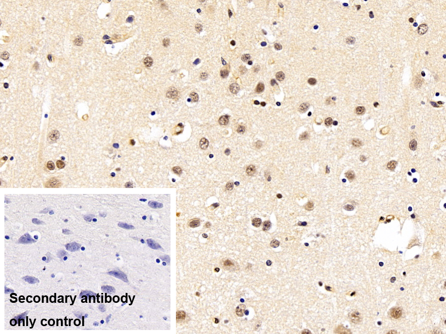 Polyclonal Antibody to Sjogren Syndrome Antigen B (SSB)