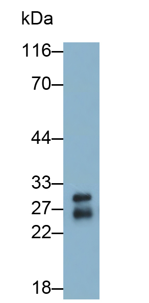 Polyclonal Antibody to Troponin I Type 1, Slow Skeletal (TNNI1)