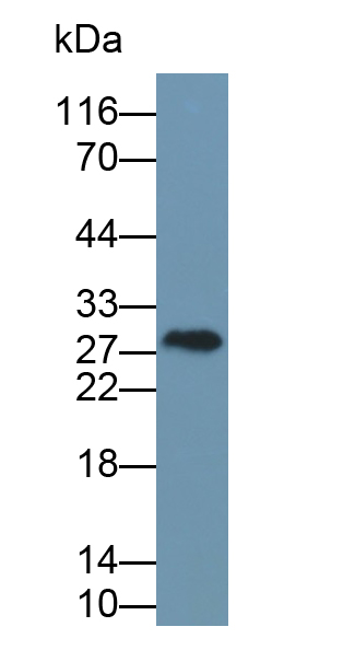 Polyclonal Antibody to Troponin I Type 1, Slow Skeletal (TNNI1)