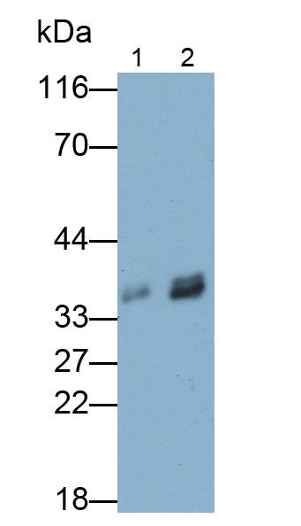 Polyclonal Antibody to Troponin T Type 1, Slow Skeletal (TNNT1)