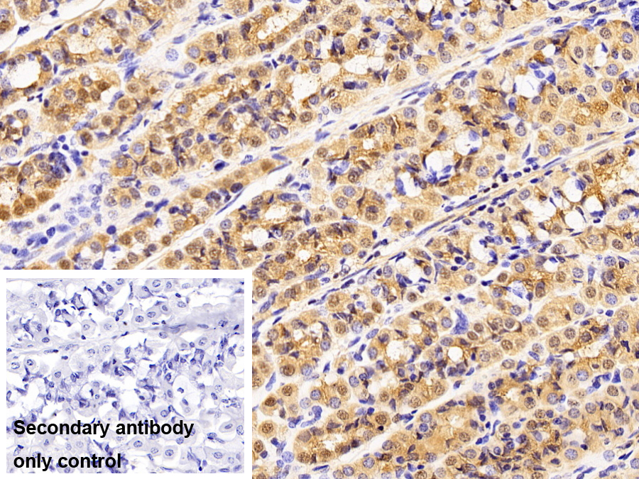 Polyclonal Antibody to Leukotriene A4 Hydrolase (LTA4H)