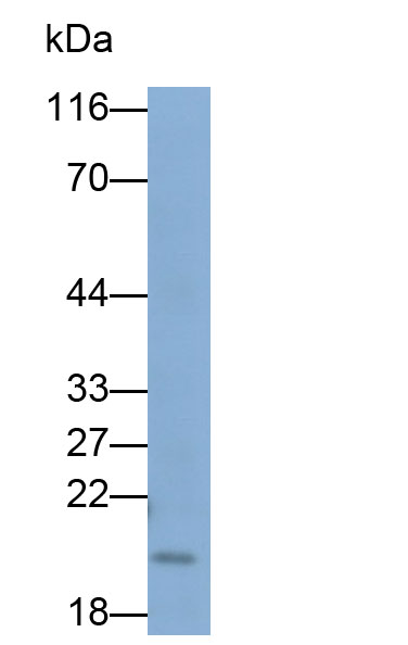 Polyclonal Antibody to Ferritin, Mitochondrial (FTMT)