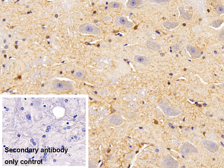 Polyclonal Antibody to Glycogen Synthase Kinase 3 Beta (GSK3b)