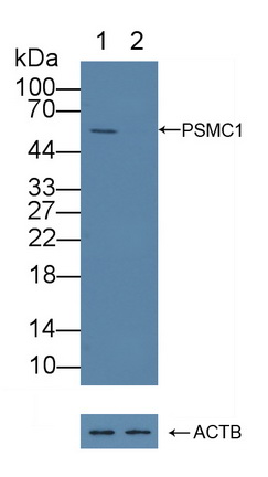 Polyclonal Antibody to Proteasome 26S Subunit, ATPase 1 (PSMC1)