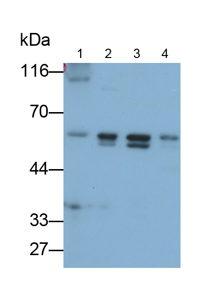Polyclonal Antibody to Proteasome 26S Subunit, ATPase 1 (PSMC1)