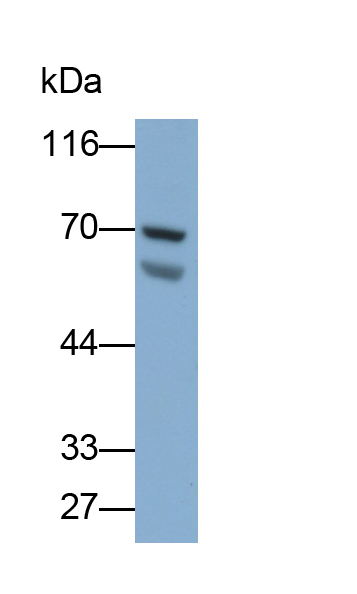 Polyclonal Antibody to Interleukin 17 Receptor C (IL17RC)