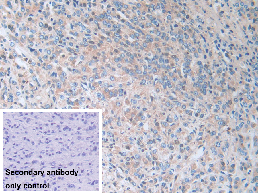 Polyclonal Antibody to Cytoplasmic Antiproteinase 3 (CAP3)