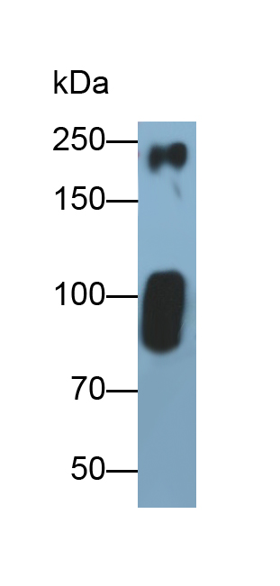 Polyclonal Antibody to Myosin Heavy Chain 6, Cardiac Muscle, Alpha (MYH6)