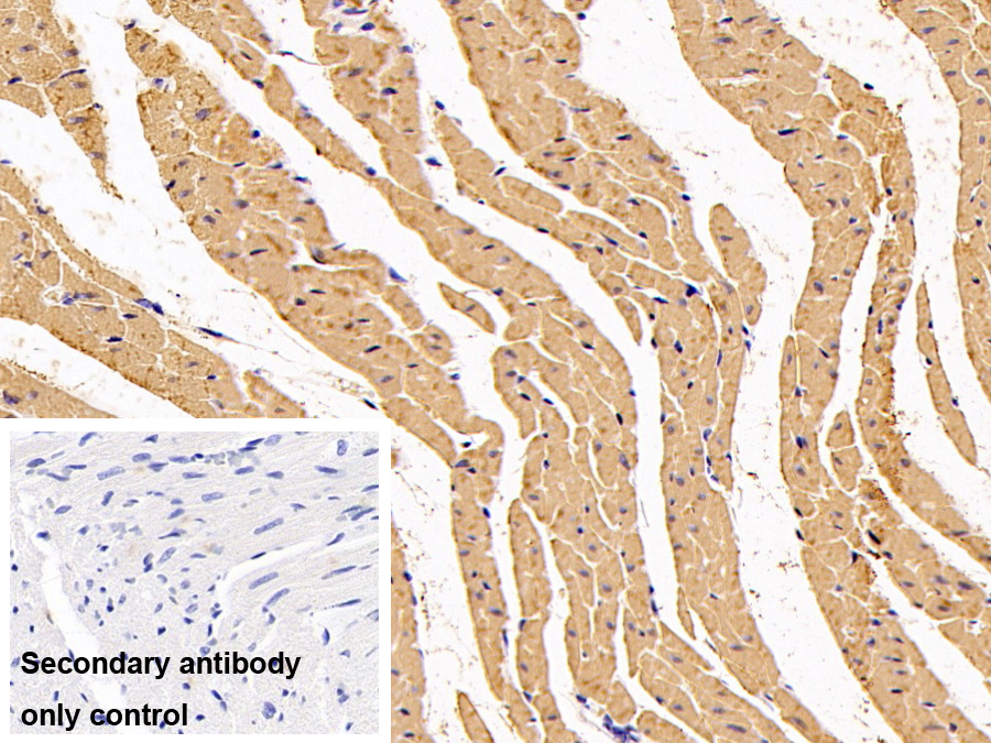 Polyclonal Antibody to Myosin Heavy Chain 6, Cardiac Muscle, Alpha (MYH6)