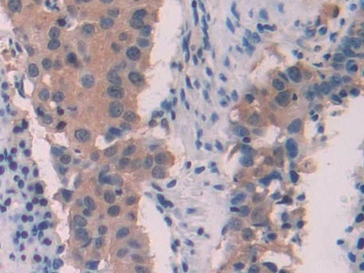 Polyclonal Antibody to Myosin Light Chain 6, Alkali, Smooth Muscle And Non Muscle (MYL6)