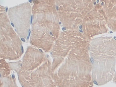 Polyclonal Antibody to Myosin ID (MYO1D)