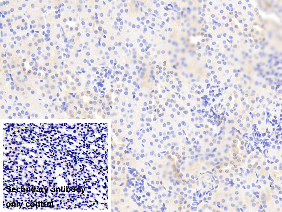 Polyclonal Antibody to Myosin IE (MYO1E)