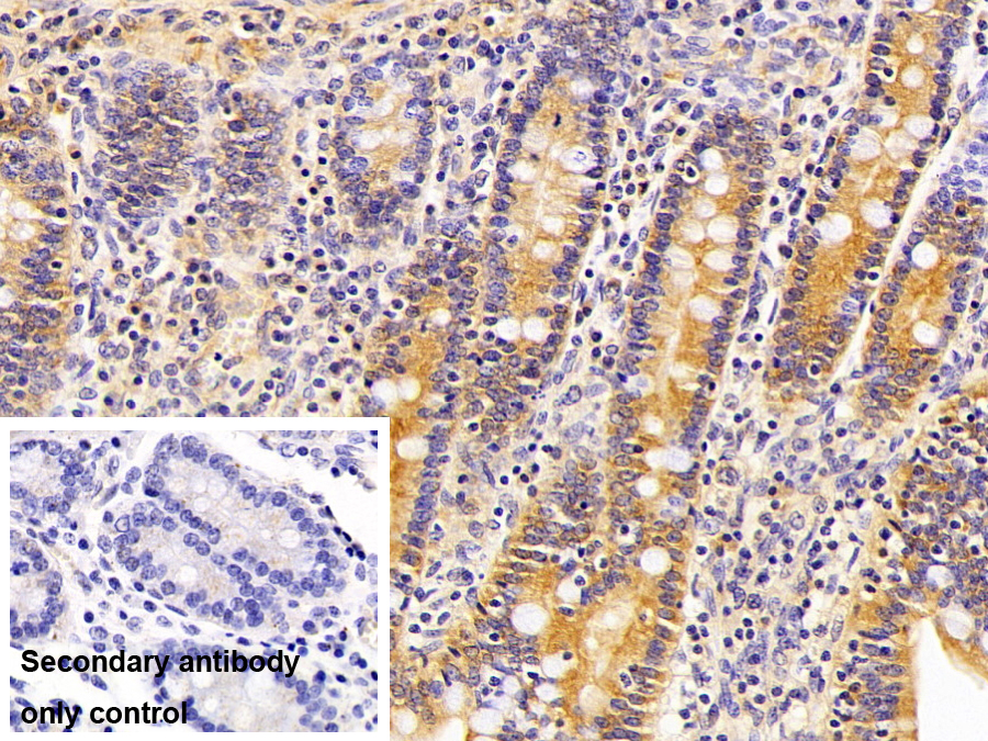 Polyclonal Antibody to Myosin Heavy Chain 14, Non Muscle (MYH14)