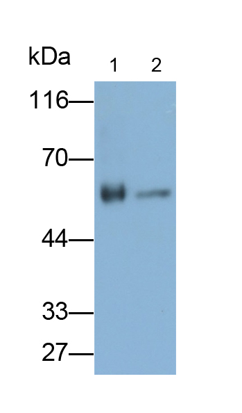 Polyclonal Antibody to Cytochrome P450 11B1 (CYP11B1)