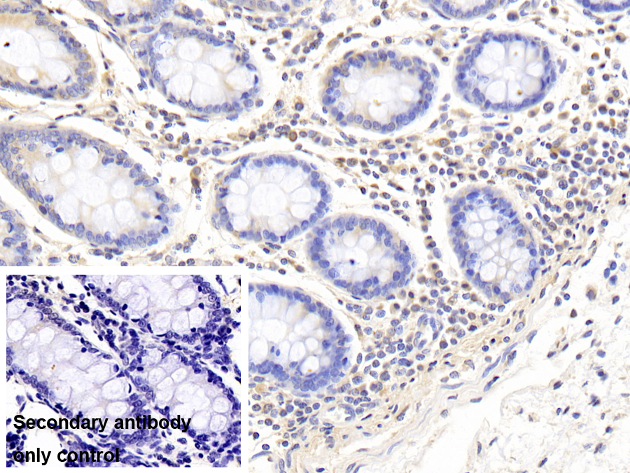 Polyclonal Antibody to ATP Binding Cassette Transporter B10 (ABCB10)