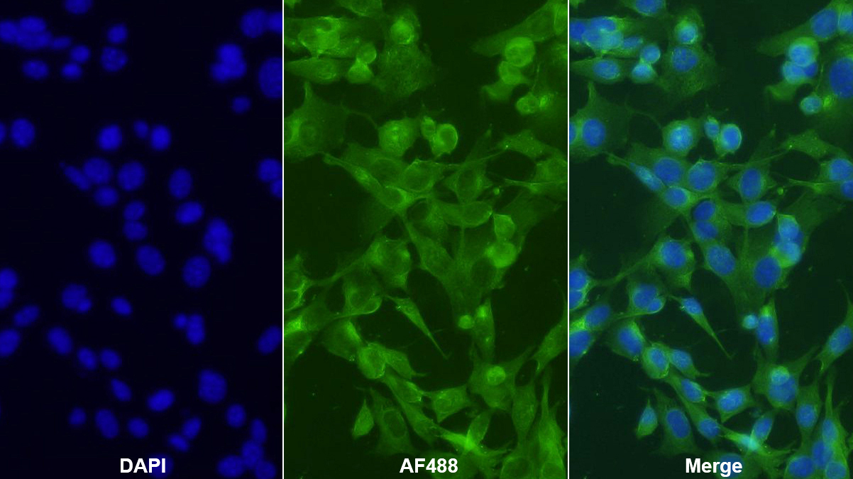 Polyclonal Antibody to ATP Binding Cassette Transporter D4 (ABCD4)