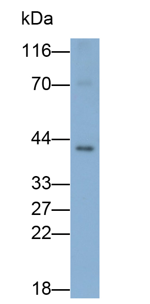Polyclonal Antibody to Acetyl Coenzyme A Acyltransferase 1 (ACAA1)