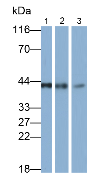 Polyclonal Antibody to Acetyl Coenzyme A Acetyltransferase 1 (ACAT1)