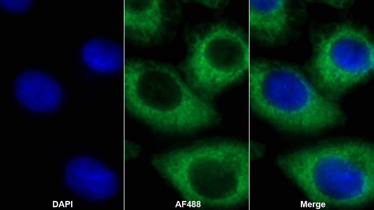 Polyclonal Antibody to Acetyl Coenzyme A Acetyltransferase 1 (ACAT1)