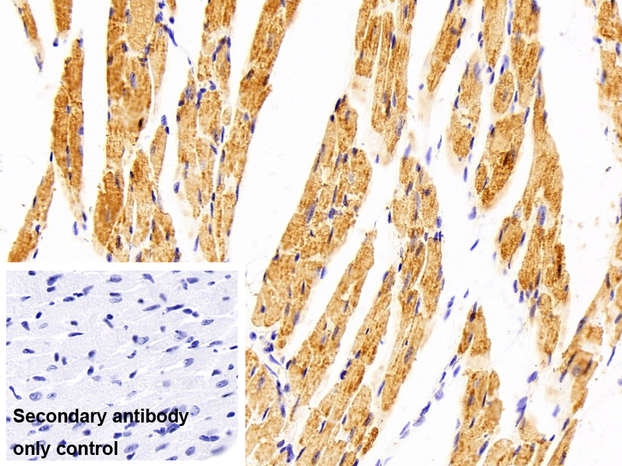 Polyclonal Antibody to Acyl Coenzyme A Synthetase Long Chain Family, Member 1 (ACSL1)