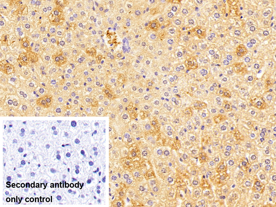 Polyclonal Antibody to Acyl Coenzyme A Synthetase Long Chain Family, Member 1 (ACSL1)