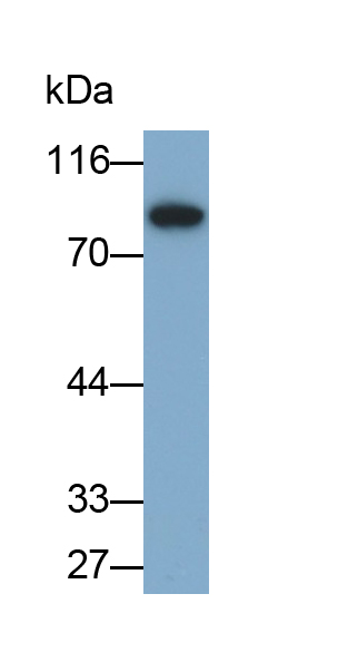 Polyclonal Antibody to Acyl Coenzyme A Synthetase Long Chain Family, Member 3 (ACSL3)