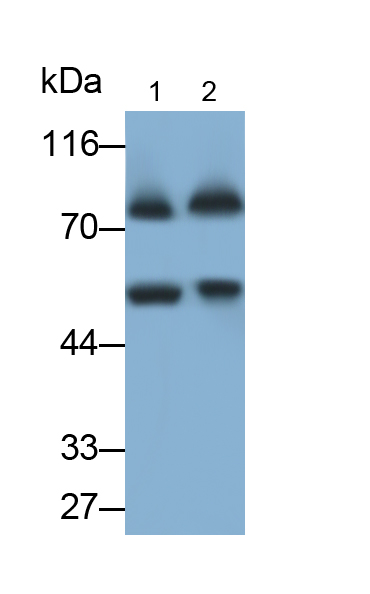 Polyclonal Antibody to Propionyl Coenzyme A Carboxylase Alpha (PCCa)