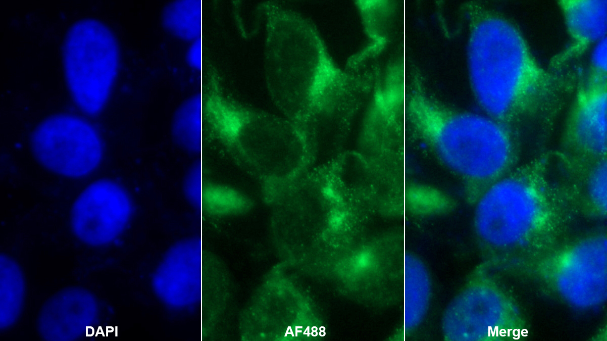 Polyclonal Antibody to Peroxisomal D3, D2-Enoyl Coenzyme A Isomerase (PECI)
