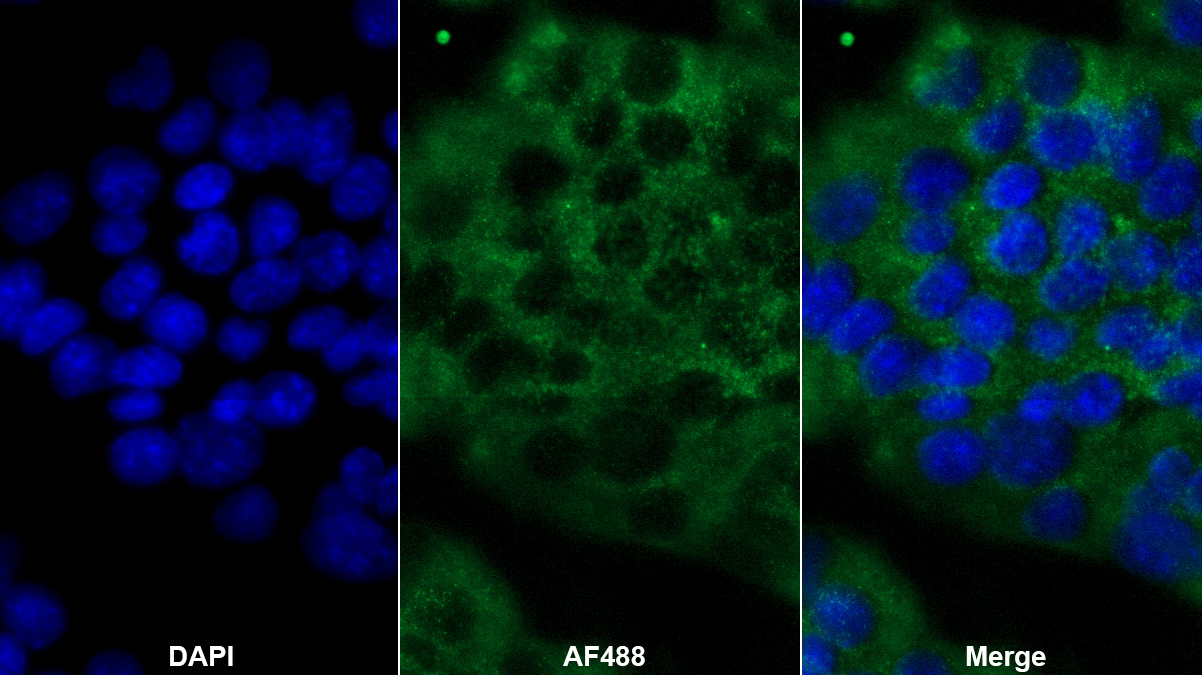 Polyclonal Antibody to Peroxisomal D3, D2-Enoyl Coenzyme A Isomerase (PECI)