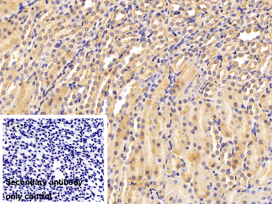 Polyclonal Antibody to Diazepam Binding Inhibitor (DBI)