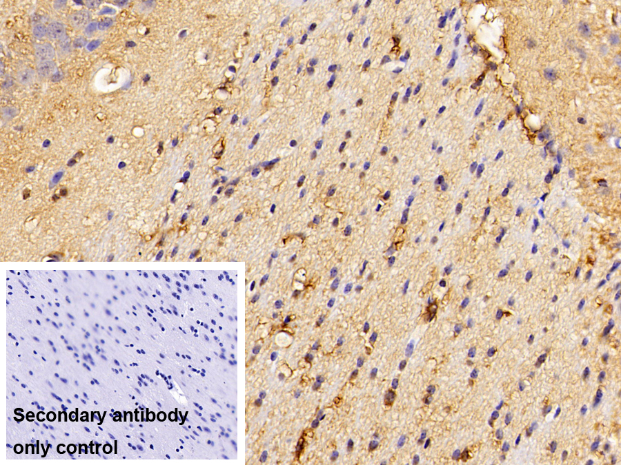 Polyclonal Antibody to Diazepam Binding Inhibitor (DBI)