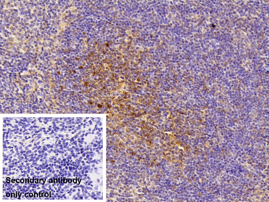 Polyclonal Antibody to Diazepam Binding Inhibitor (DBI)