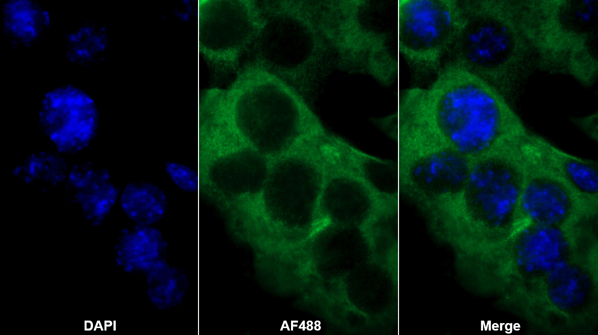 Polyclonal Antibody to Diazepam Binding Inhibitor (DBI)