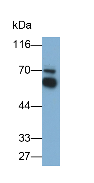 Polyclonal Antibody to Regulator Of G Protein Signaling 6 (RGS6)