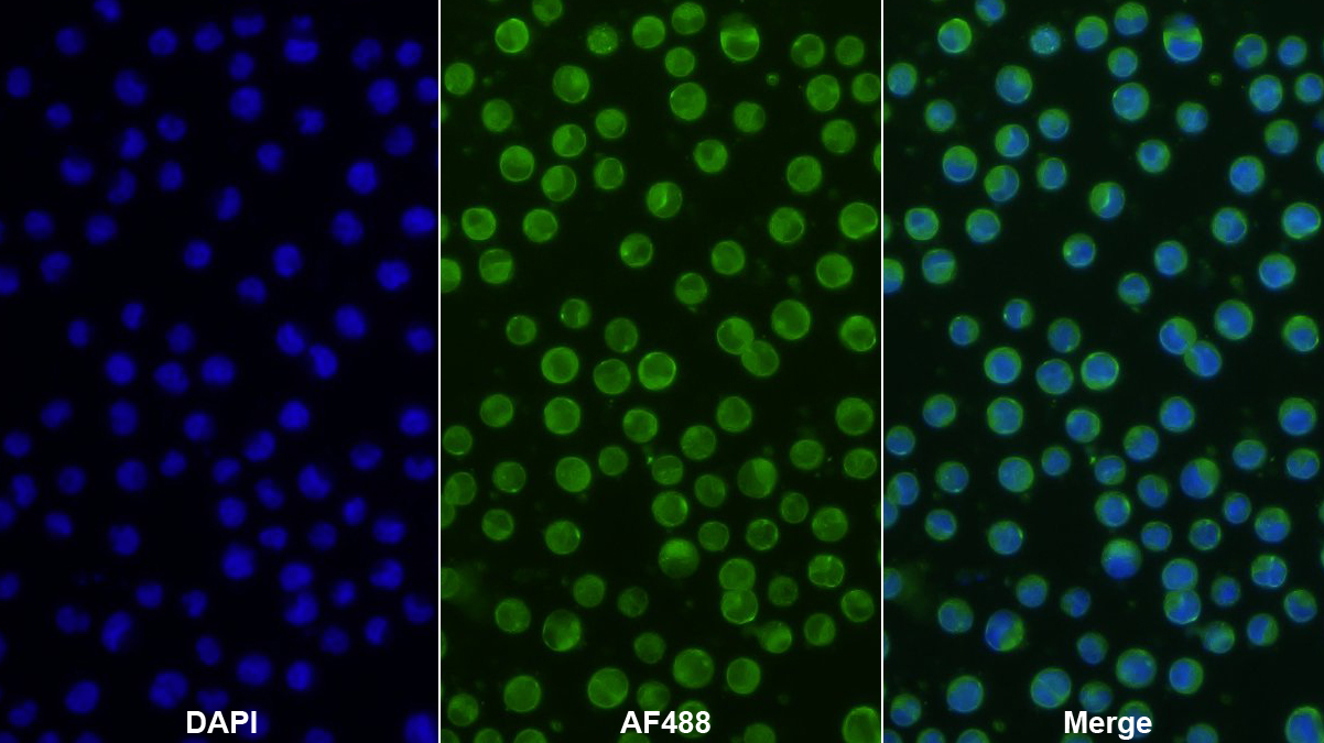 Polyclonal Antibody to Killer Cell Immunoglobulin Like Receptor 2DS2 (KIR2DS2)