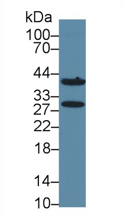 Polyclonal Antibody to Bisphosphoglycerate Mutase (BPGM)