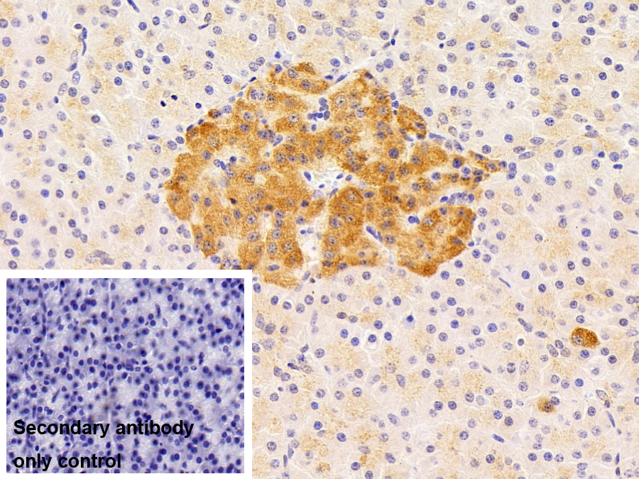 Polyclonal Antibody to Apolipoprotein L (APOL1)