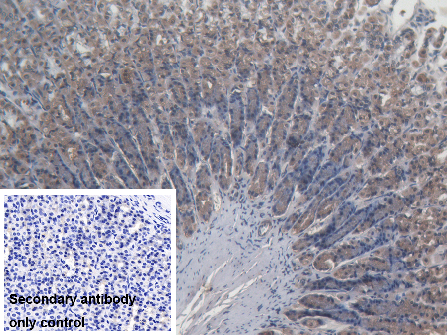 Polyclonal Antibody to Pyruvate Dehydrogenase Phosphatase 2 (PDP2)