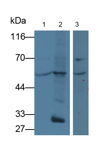Polyclonal Antibody to Lipolysis Stimulated Lipoprotein Receptor (LSR)