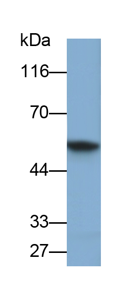 Polyclonal Antibody to Keratin 6C (KRT6C)