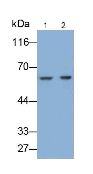 Polyclonal Antibody to Asparagine Synthetase (ASNS)