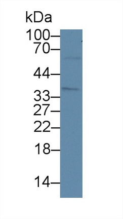 Polyclonal Antibody to High Mobility Group Protein 20B (HMG20B)