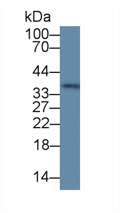 Polyclonal Antibody to High Mobility Group Protein 20B (HMG20B)